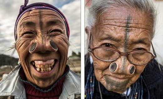 Làm đẹp kinh dị: