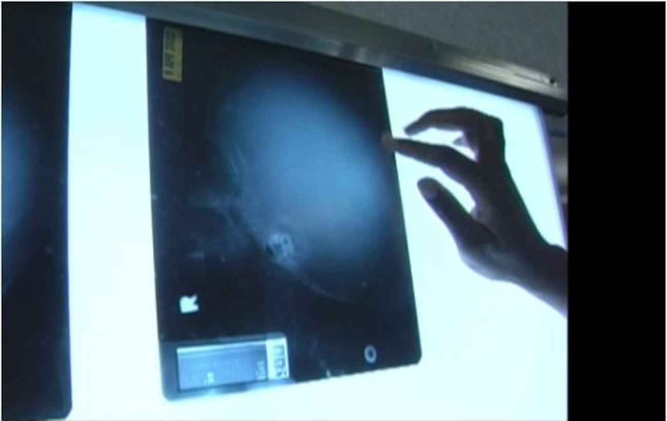 Cậu bé sinh ra không có não đã sống cuộc đời như thế nào?- Ảnh 3.