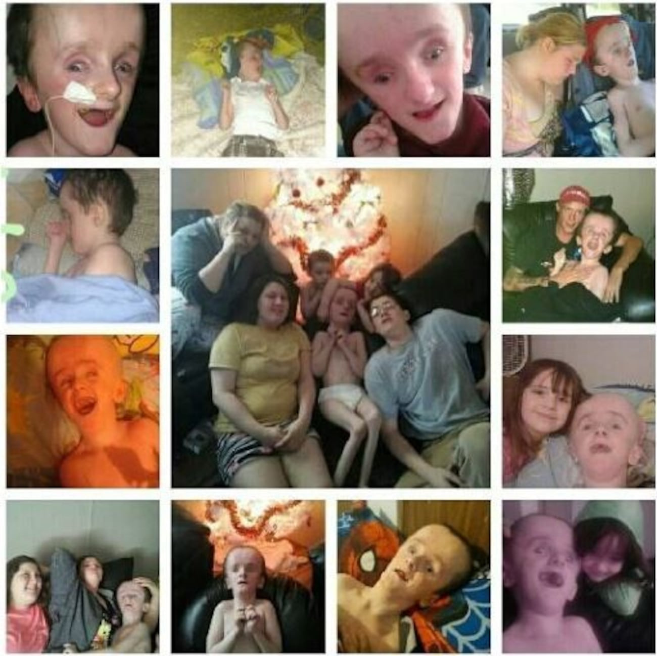 Cậu bé sinh ra không có não đã sống cuộc đời như thế nào?- Ảnh 4.