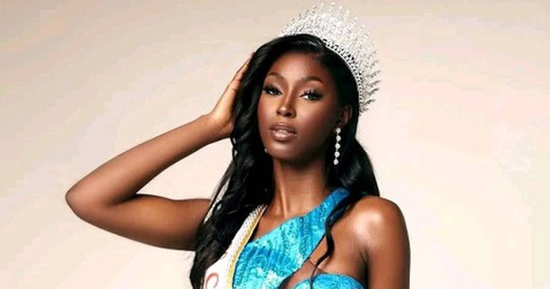 Đương kim Miss Cameroon 2025: 24 tuổi bị tạm giam