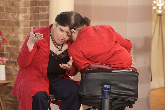 Cặp song sinh dính liền giấu nhau giới tính thật trong nhiều thập kỷ