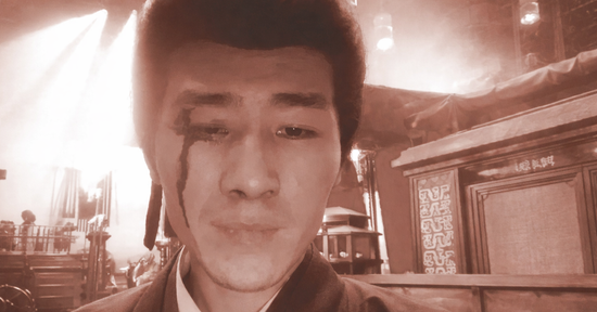 Diễn viên tố đoàn phim bỏ mặc sau tai nạn phải khâu 6 mũi