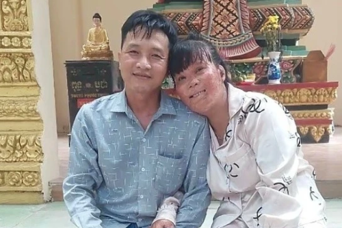 Người phụ nữ cứu con của bạn trai khỏi biển lửa, bị bỏng 78% cơ thể 19 năm trước, giờ ra sao?