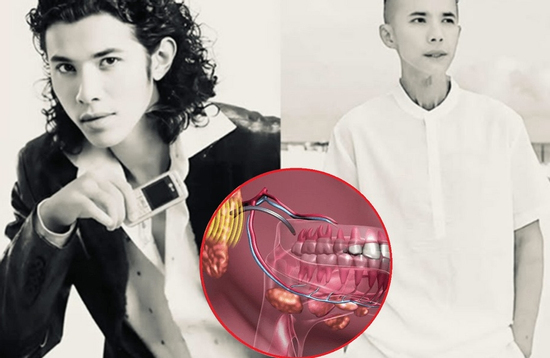 Kasim Hoàng Vũ qua đời vì căn bệnh dễ bị bỏ qua: Triệu chứng ban đầu mờ nhạt, những ai cần đặc biệt cảnh giác?