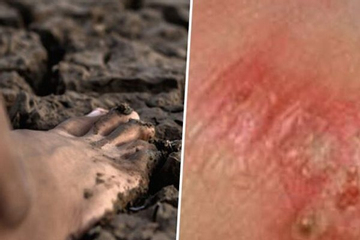 Thái Lan cảnh báo khẩn về dịch 