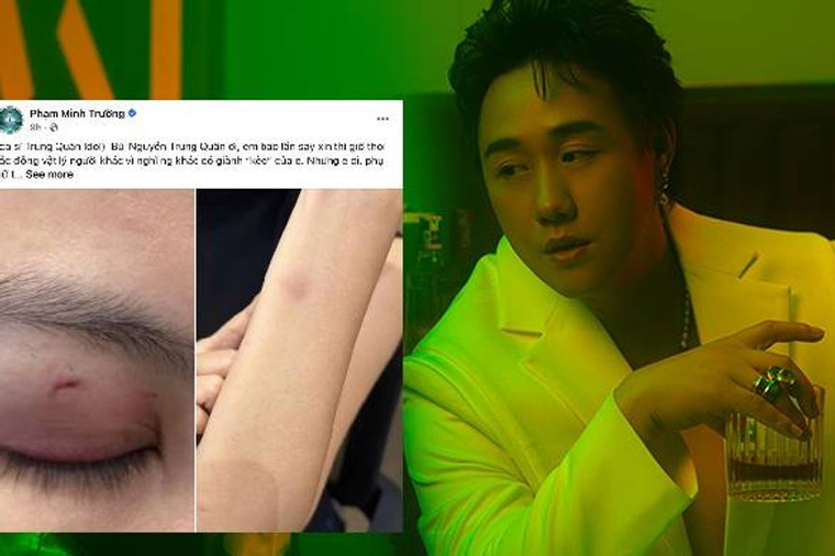 Nóng: Công an vào cuộc vụ ca sĩ Trung Quân Idol bị tố hành hung phụ nữ ở TPHCM