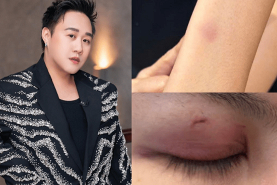 Mới nhất drama hành hung nữ bác sĩ: Trung Quân thông báo ngưng hoạt động rồi xoá post sau 10 phút