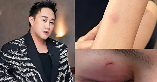 5 vụ sao Việt đánh người: Người thừa nhận say rượu, kẻ bị tát giữa phim trường