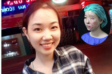 Hành trình phi thường của nữ sinh Đắk Lắk bị tạt axit nhầm sau 10 năm