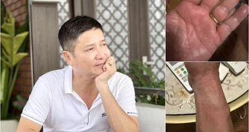 NSƯT Chí Trung mắc bệnh lạ, mất ngủ triền miên