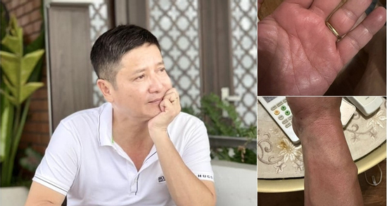 NSƯT Chí Trung mắc bệnh lạ, mất ngủ triền miên