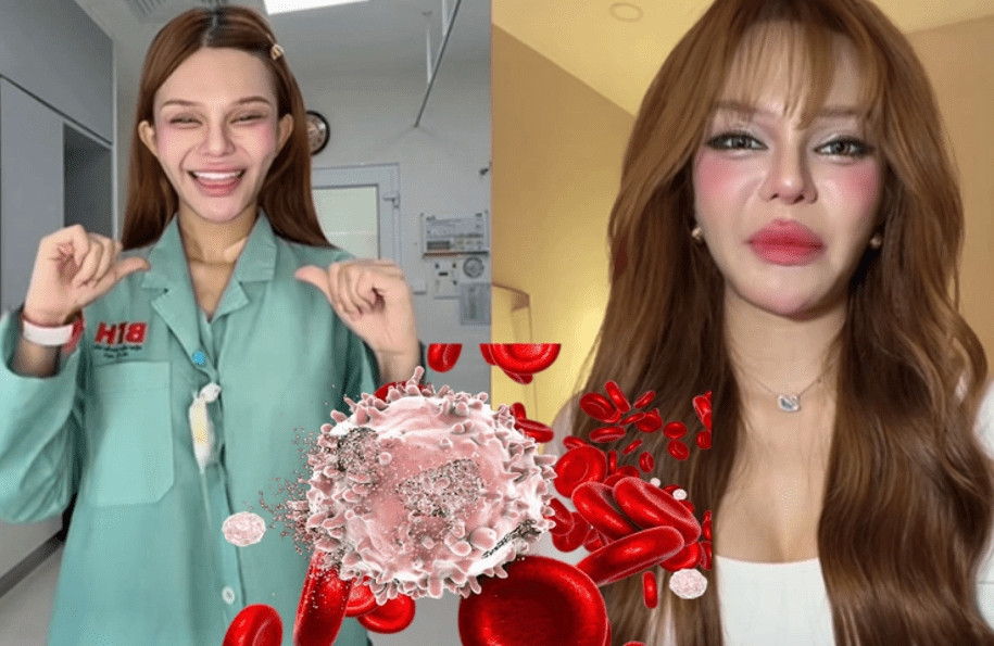 Hành trình 15 lần 'dao kéo' của Đan Thy, tiktoker 12 triệu follower vừa tiết lộ mắc ung thư插图6 Hành trình 15 lần 'dao kéo' của Đan Thy, tiktoker 12 triệu follower vừa tiết lộ mắc ung thư插图6