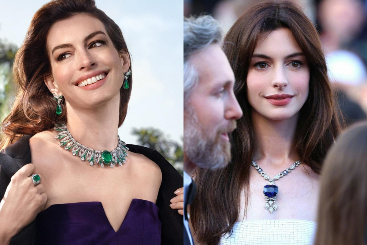 anne hathaway eye condition surgery 1