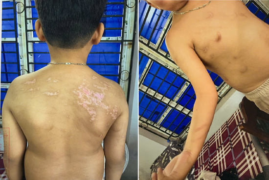 Thi hành Lệnh bắt tạm giam Nguyễn Hà Chung, nạn nhân là con ruột mới hơn 7 tuổi