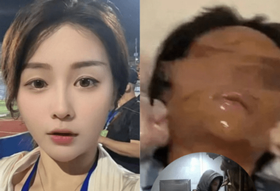 Nữ streamer xinh đẹp bị 'hủy dung' sau khi mở gói hàng, danh tính shipper gây sốc