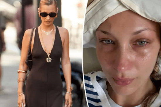 Bella Hadid đau đớn, tàn tạ không nhận ra khi bệnh nặng tái phát