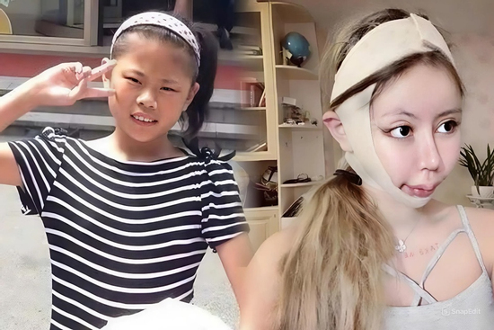 Cô gái chi hơn 15 tỷ đồng phẫu thuật thẩm mỹ để giống thần tượng, trải qua hơn 100 lần 'dao kéo'