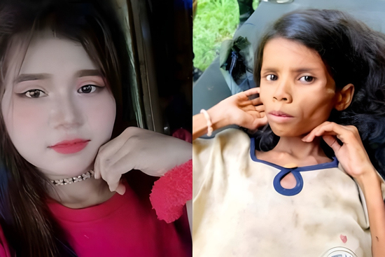 Bé gái mất tích 47 ngày trong rừng, gầy trơ xương khi được tìm thấy, giờ ra sao?