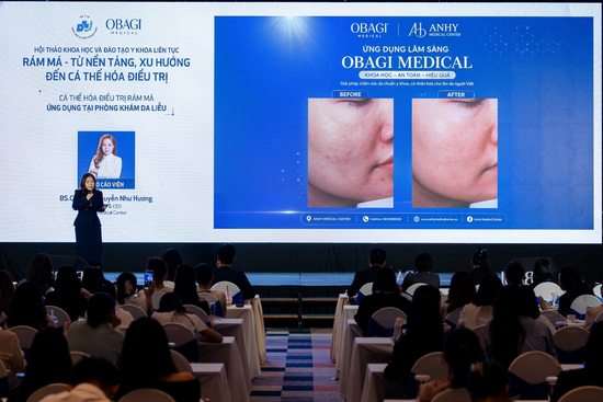 Nu-Derm® FX cải tiến: Giải pháp chăm sóc toàn diện cho tình trạng rám má