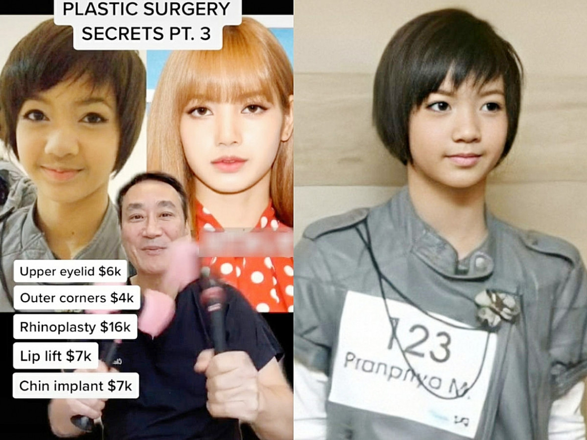 bi an nhan sac lisa cua blackpink Dinh cao nghe thuat trang diem hay phau thuat hinh anh 4