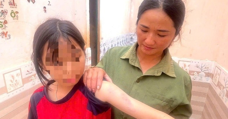 Người dân kể phút lốc xoáy cuốn qua: 'Gió rít mạnh, các con tôi hoảng loạn bỏ chạy'